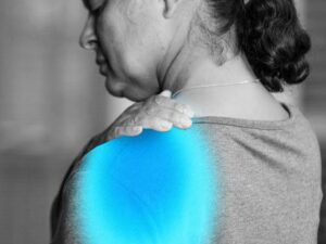 10 Health Facts About Frozen Shoulder
